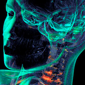 Scan of human head